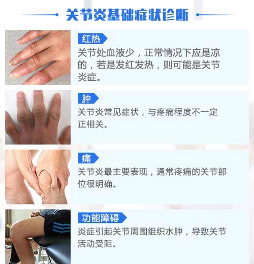【世界关节炎日】关爱身体的每一个关节 【世界关节炎日】关爱身体的每一个关节