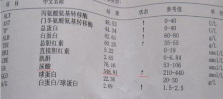 痛风,痛风,痛者皆疯……关注11月7日晚CDTV3《热线188》频道听医生为你讲述 痛风,痛风,痛者皆疯……关注11月7日晚CDTV3《热线188》频道听医生为你讲述
